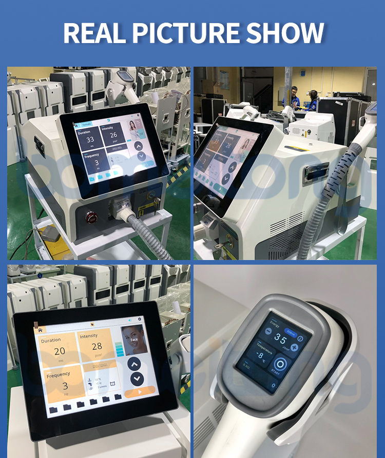 bm106 laser hair removal