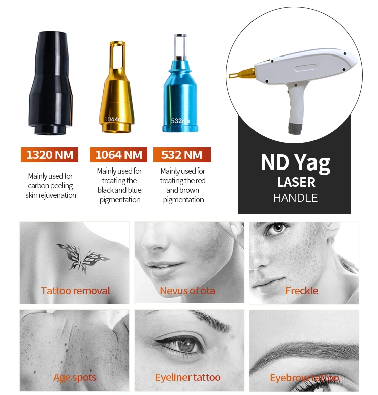 nd yag laser for acne scars
