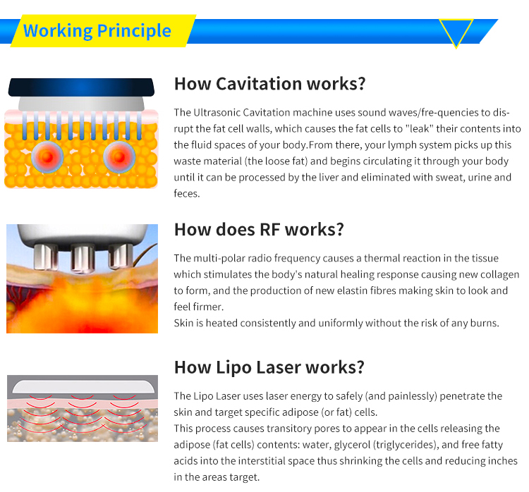 zeny 5 in 1 cavitation machine
