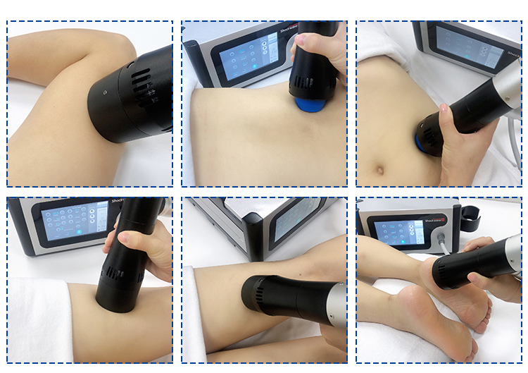shockwave therapy machine