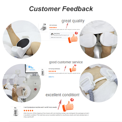 customer reviews