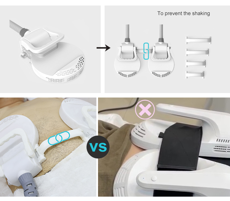 HIEMT EMS body handles