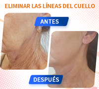 Máquina hifu para adelgazar el cuerpo