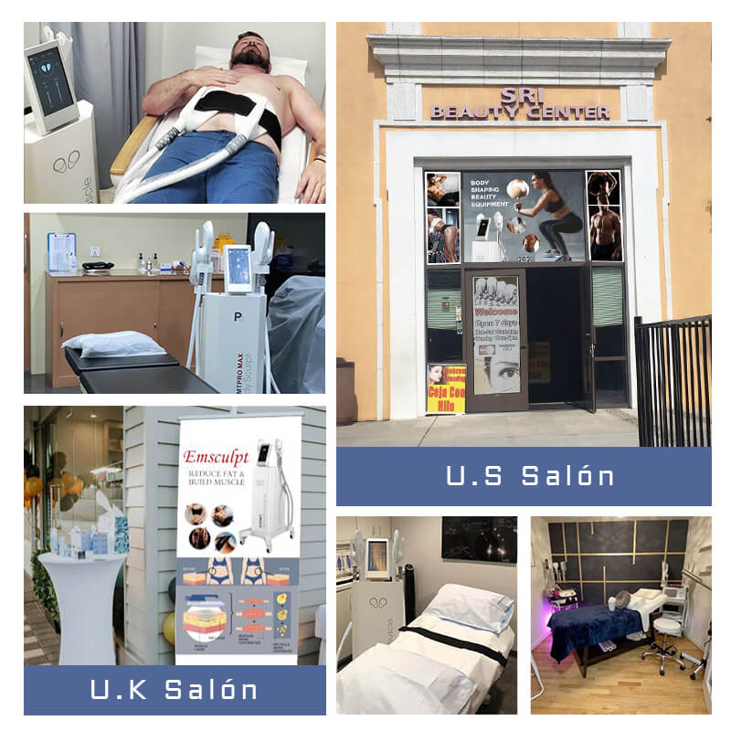 ems machine customer feedback