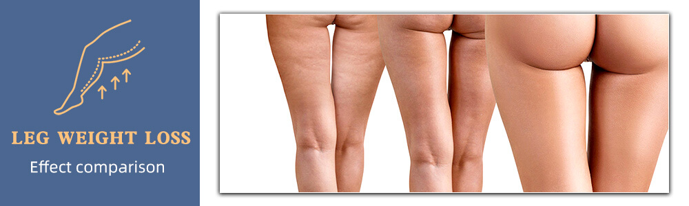 emsculpt weight loss