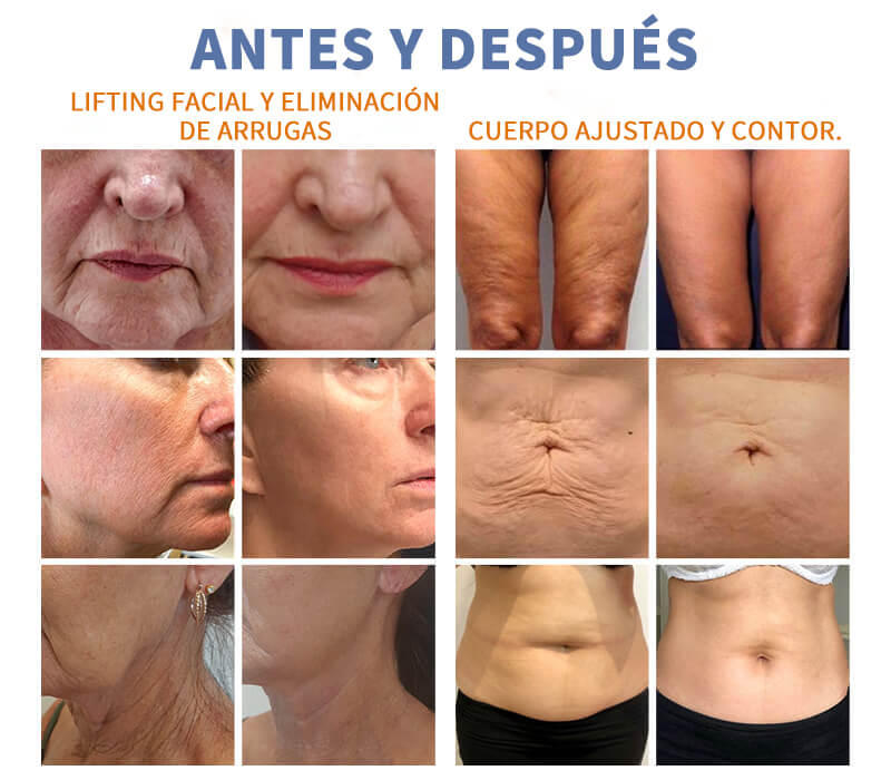 Confronto tra gli effetti prima e dopo