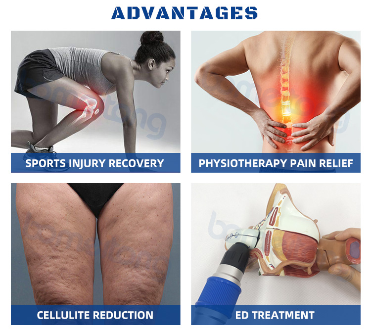 Extracorporeal radial shockwave therapy machine for ed treatment pain relief