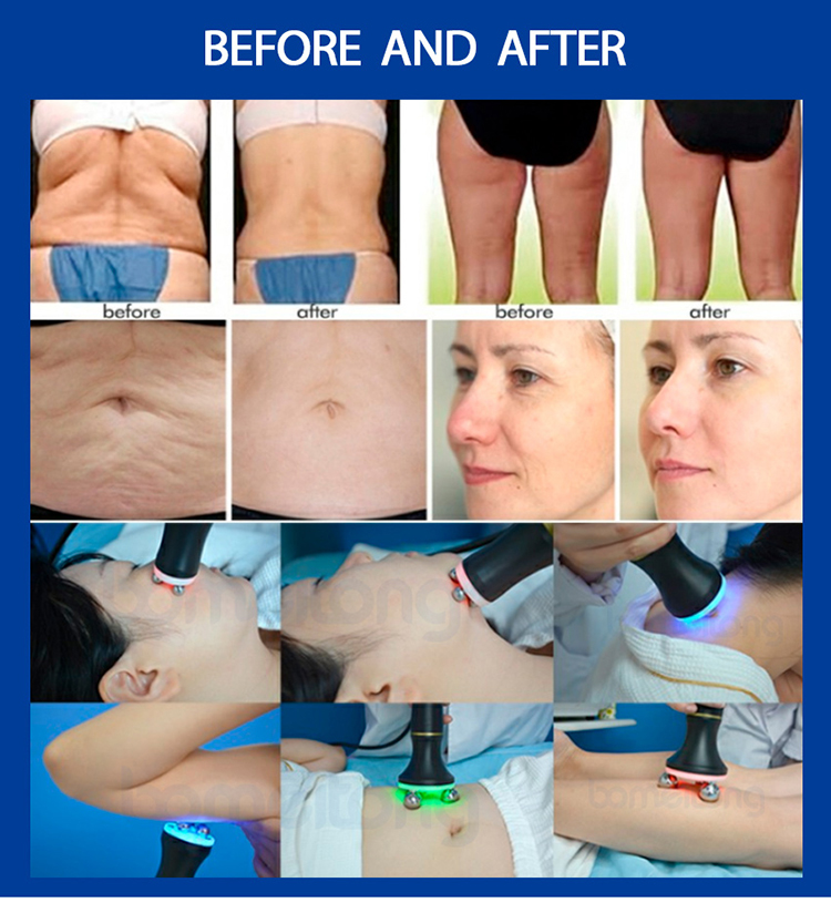 RF machine rotation roller skin tightening weight loss face lift professional