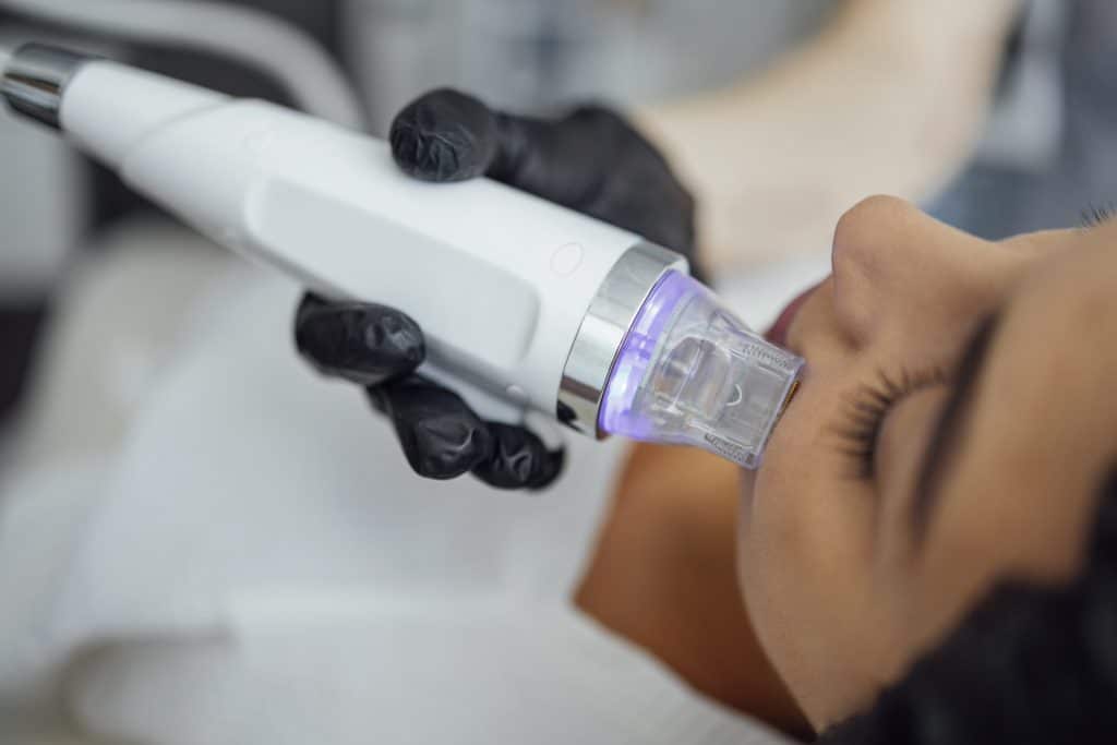 Microneedling RF Machine