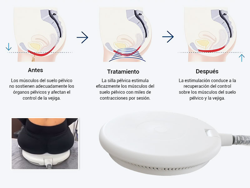 Opción de entrenamiento del suelo pélvico