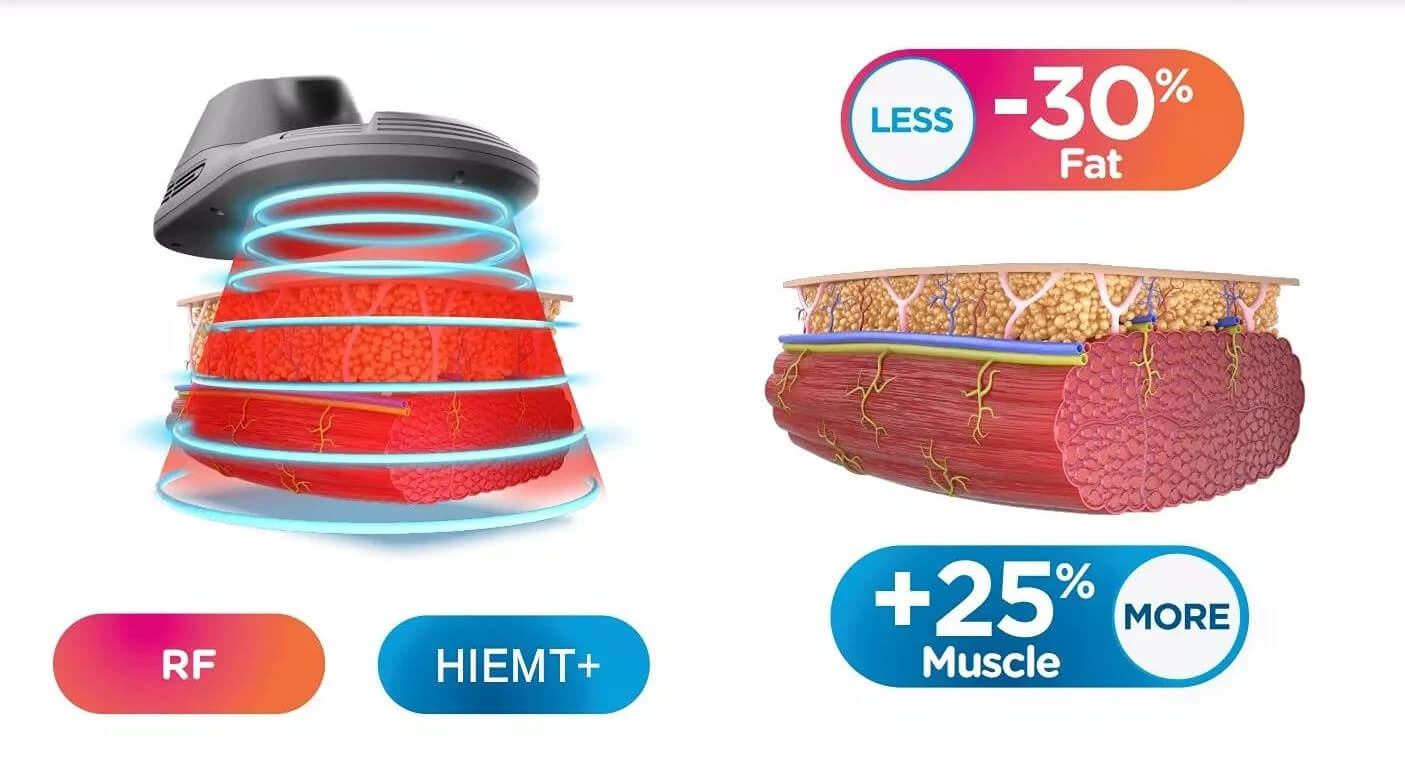 emMusculpting machine for sale