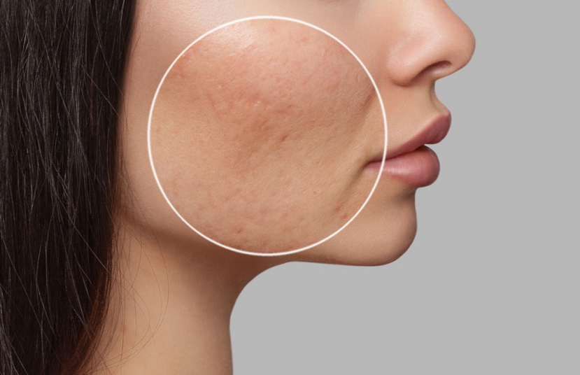 Top 8 Essential Factors To Consider When Purchasing Picosecond Laser Equipment